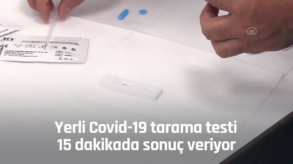 Corona Viruse Yakalanirsam Nasil Geciririm Sorusu Bu Test Ile Yanit Buluyor Saglik Haberleri Ntv